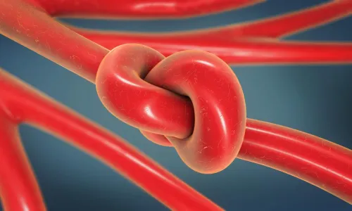 جلطات الدم قد لا تلاحظها.. لكن هذه أعراضها وعواقبها!